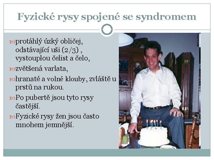Fyzické rysy spojené se syndromem protáhlý úzký obličej, odstávající uši (2/3) , vystouplou čelist