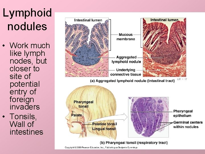 Lymphoid nodules • Work much like lymph nodes, but closer to site of potential