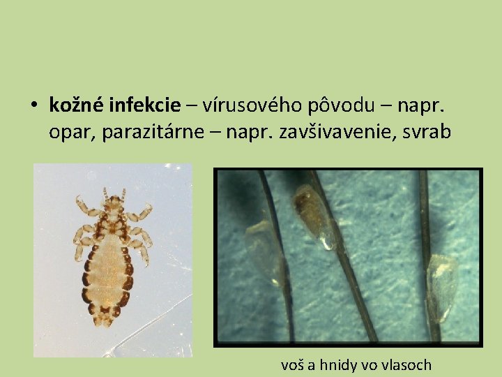  • kožné infekcie – vírusového pôvodu – napr. opar, parazitárne – napr. zavšivavenie,