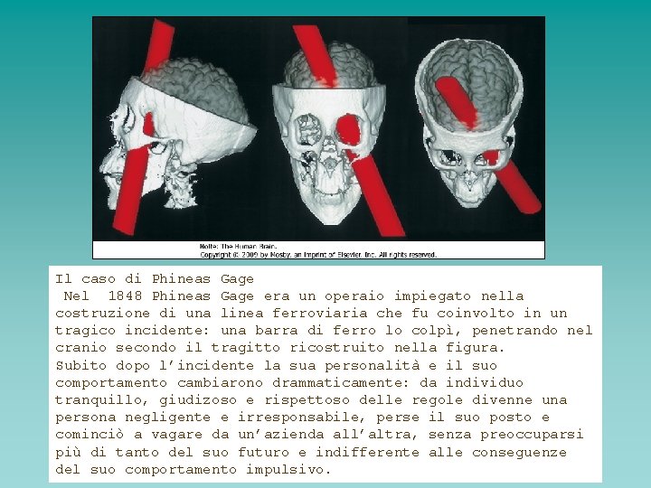 Il caso di Phineas Gage Nel 1848 Phineas Gage era un operaio impiegato nella