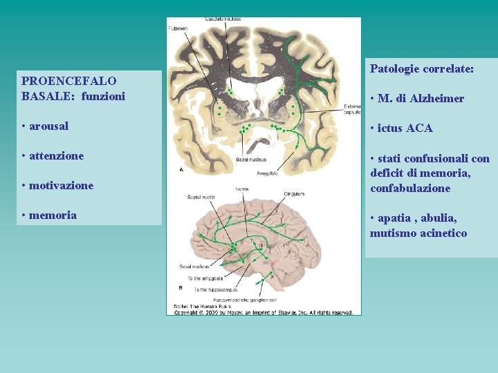 PROENCEFALO BASALE: funzioni Patologie correlate: • M. di Alzheimer • arousal • ictus ACA