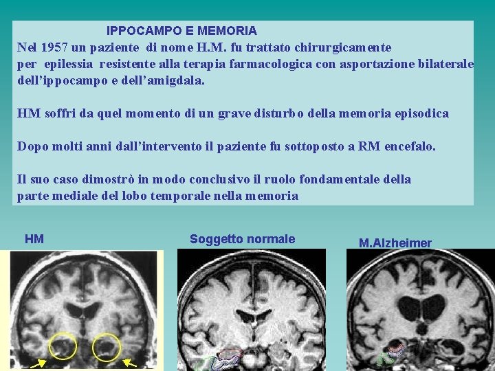 IPPOCAMPO E MEMORIA Nel 1957 un paziente di nome H. M. fu trattato chirurgicamente