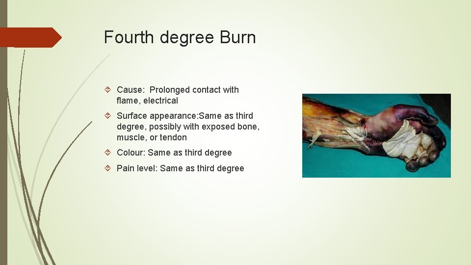 Fourth degree Burn Cause: Prolonged contact with flame, electrical Surface appearance: Same as third