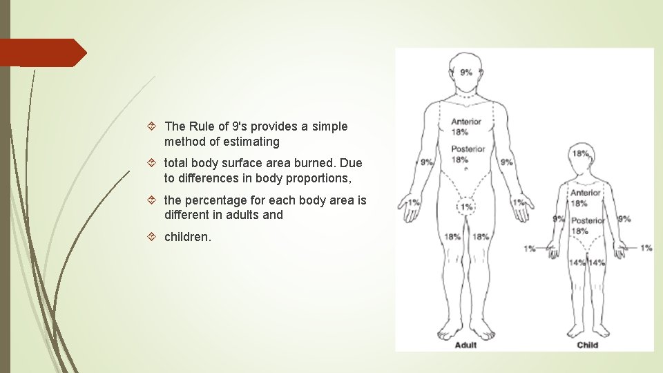  The Rule of 9's provides a simple method of estimating total body surface