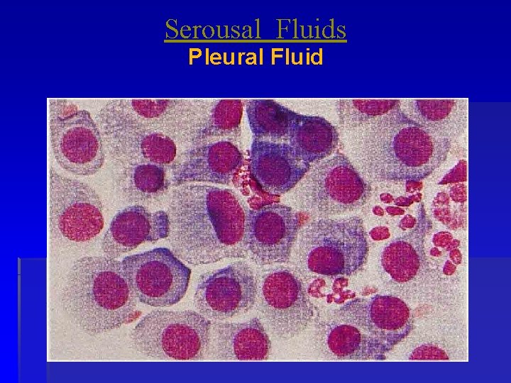 Serousal Fluids Pleural Fluid 