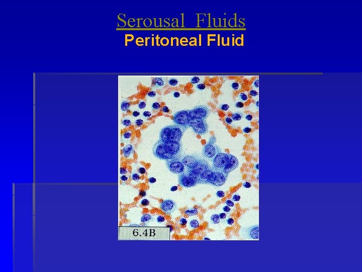 Serousal Fluids Peritoneal Fluid 