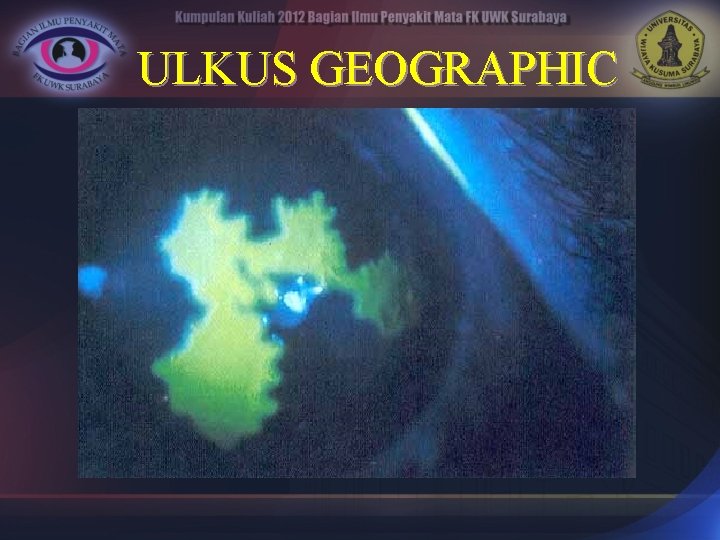 ULKUS GEOGRAPHIC 