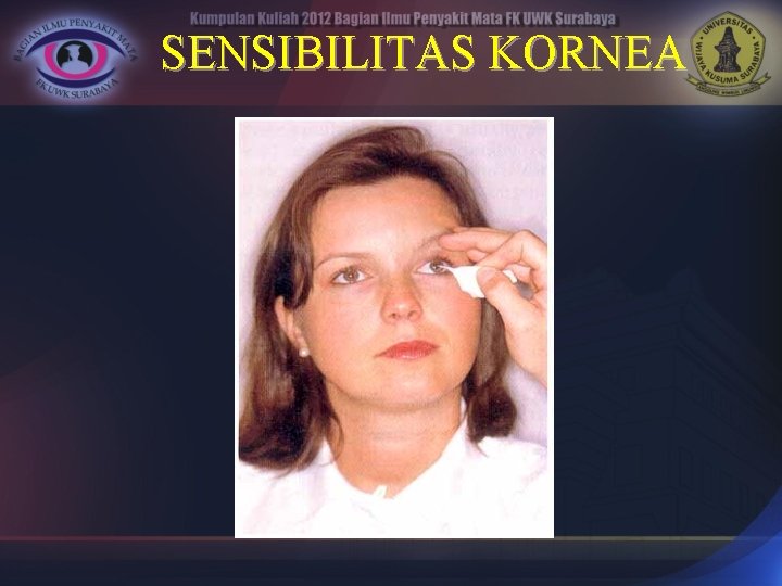 SENSIBILITAS KORNEA 