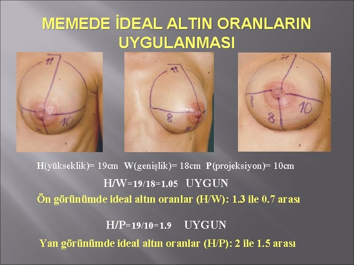 MEMEDE İDEAL ALTIN ORANLARIN UYGULANMASI H(yükseklik)= 19 cm W(genişlik)= 18 cm P(projeksiyon)= 10 cm