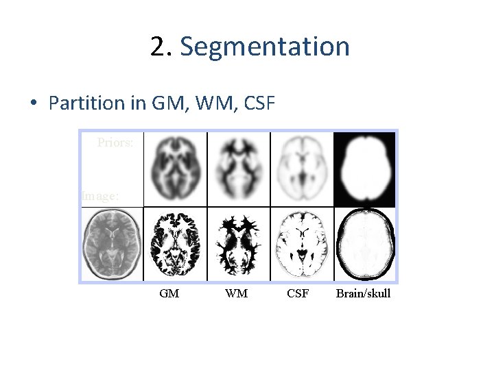 2. Segmentation • Partition in GM, WM, CSF Priors: Image: GM WM CSF Brain/skull