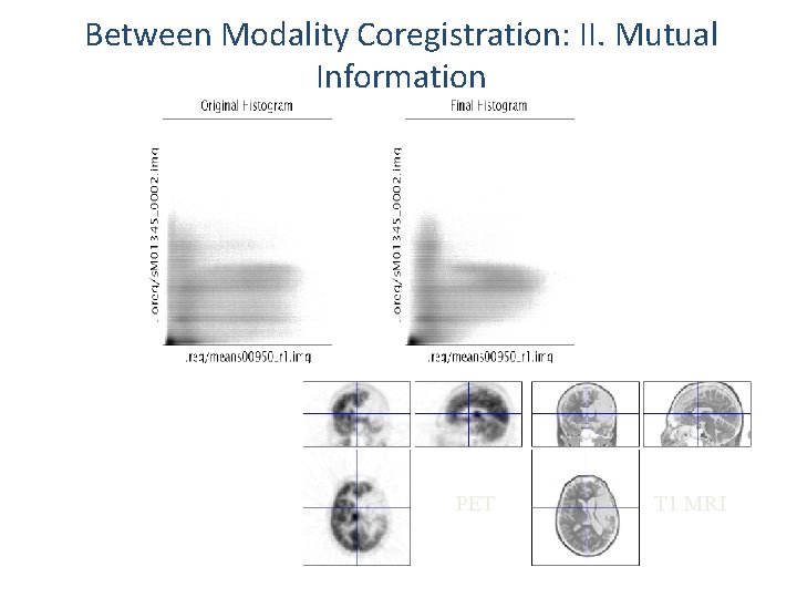 Between Modality Coregistration: II. Mutual Information PET T 1 MRI 