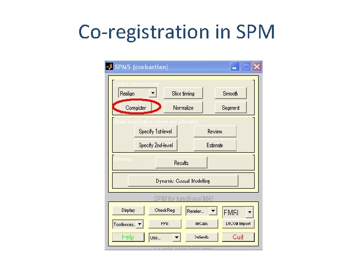 Co-registration in SPM 