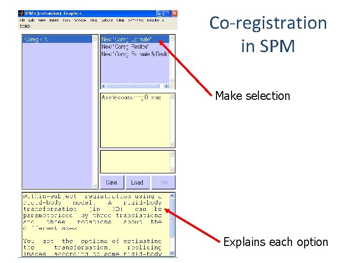 Co-registration in SPM Make selection Explains each option 
