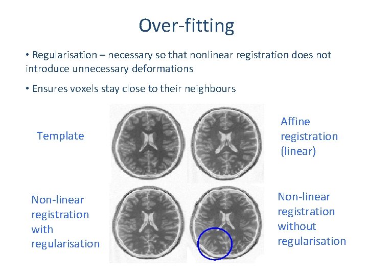 Over-fitting • Regularisation – necessary so that nonlinear registration does not introduce unnecessary deformations