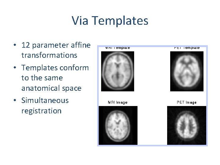 Via Templates • 12 parameter affine transformations • Templates conform to the same anatomical