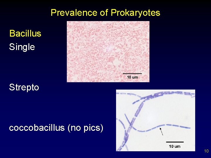 Prevalence of Prokaryotes Bacillus Single Strepto coccobacillus (no pics) 10 