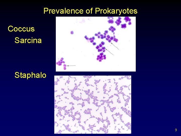 Prevalence of Prokaryotes Coccus Sarcina Staphalo 9 