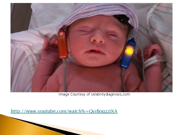 Image Courtesy of celebritydiagnosis. com http: //www. youtube. com/watch? v=Qvr. Bogzzi. XA 