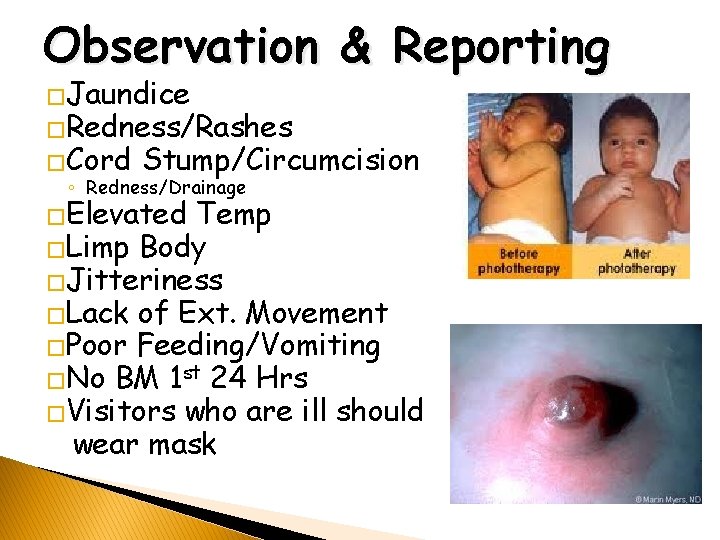 Observation & Reporting �Jaundice �Redness/Rashes �Cord Stump/Circumcision ◦ Redness/Drainage �Elevated Temp �Limp Body �Jitteriness