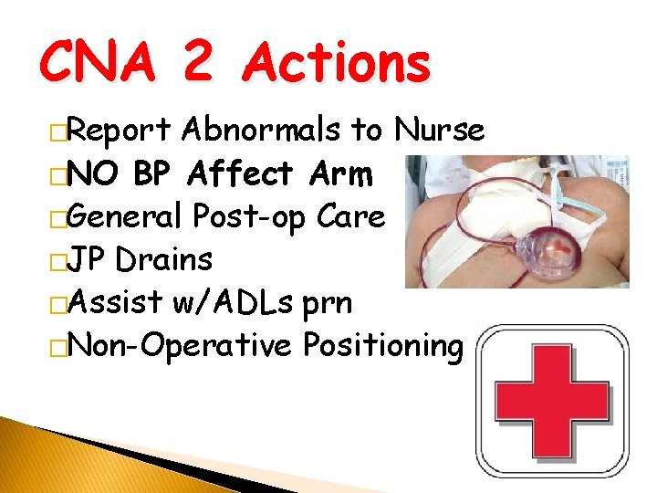 CNA 2 Actions �Report Abnormals to Nurse �NO BP Affect Arm �General Post-op Care