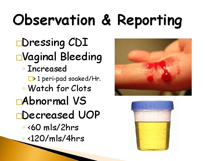 Observation & Reporting �Dressing CDI �Vaginal Bleeding ◦ Increased �> 1 peri-pad soaked/Hr. ◦