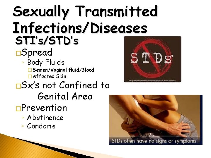 Sexually Transmitted Infections/Diseases STI’s/STD’s �Spread ◦ Body Fluids �Semen/Vaginal fluid/Blood �Affected Skin �Sx’s not