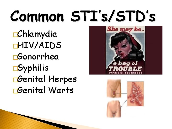 Common STI’s/STD’s �Chlamydia �HIV/AIDS �Gonorrhea �Syphilis �Genital Herpes �Genital Warts 