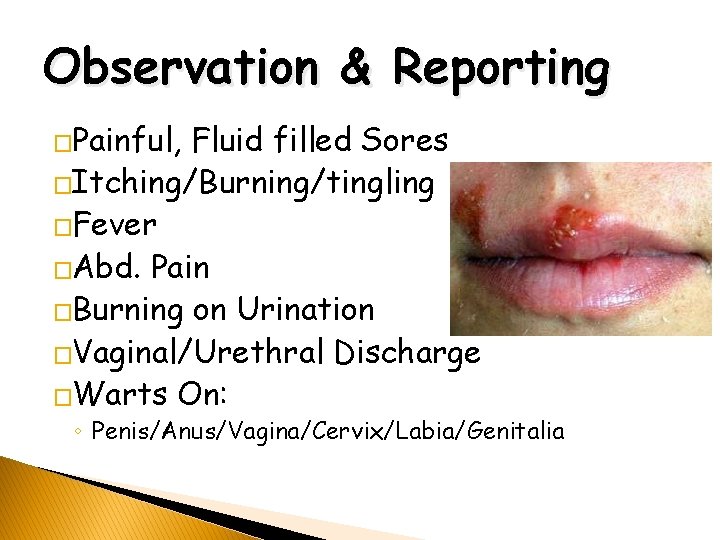 Observation & Reporting �Painful, Fluid filled Sores �Itching/Burning/tingling �Fever �Abd. Pain �Burning on Urination