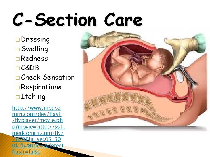 C-Section Care � Dressing � Swelling � Redness � C&DB � Check Sensation �