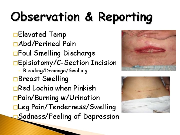 Observation & Reporting � Elevated Temp � Abd/Perineal Pain � Foul Smelling Discharge �