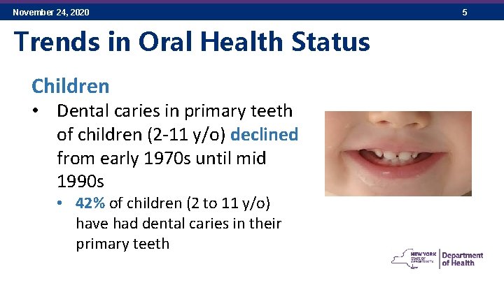 November 24, 2020 Trends in Oral Health Status Children • Dental caries in primary