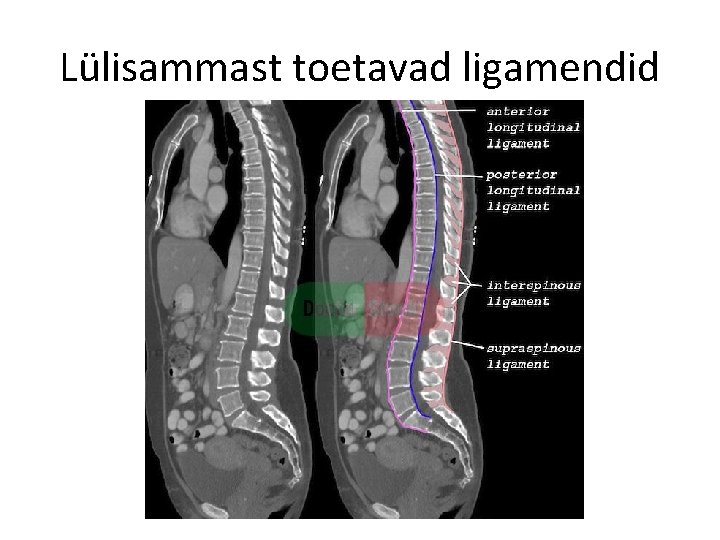 Lülisammast toetavad ligamendid 