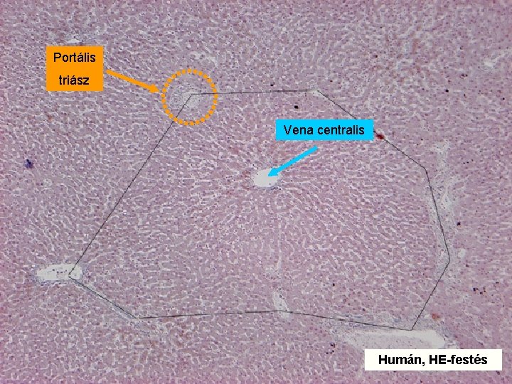 Portális triász Vena centralis Humán, HE-festés 