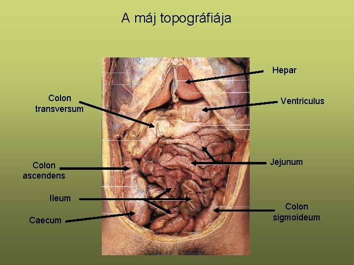 A máj topográfiája Hepar Colon transversum Colon ascendens Ileum Caecum Ventriculus Jejunum Colon sigmoideum