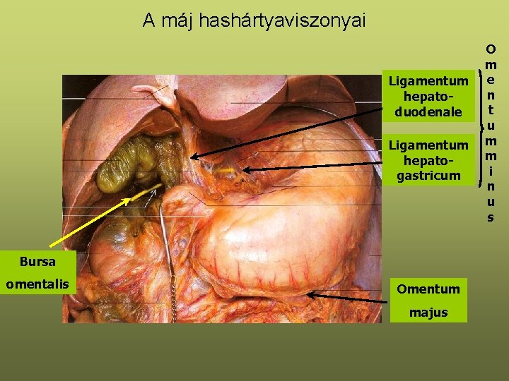 A máj hashártyaviszonyai Ligamentum hepatoduodenale Ligamentum hepatogastricum Bursa omentalis Omentum majus O m e
