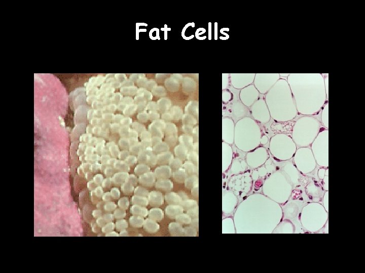 Fat Cells 