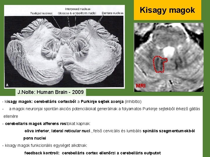 Kisagy magok MRI J. Nolte: Human Brain - 2009 - kisagy magok: cerebelláris cortexből