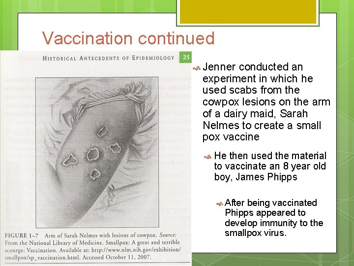 Vaccination continued Jenner conducted an experiment in which he used scabs from the cowpox