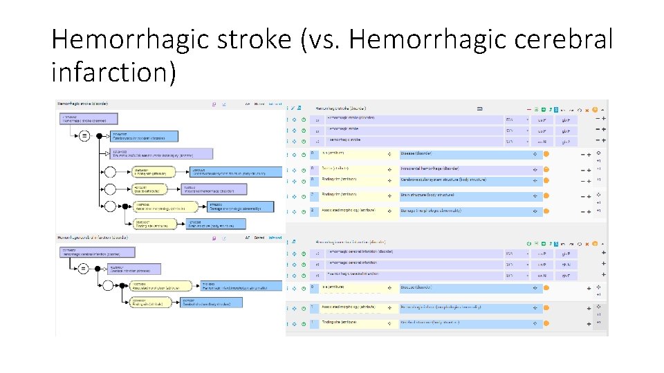 Hemorrhagic stroke (vs. Hemorrhagic cerebral infarction) 