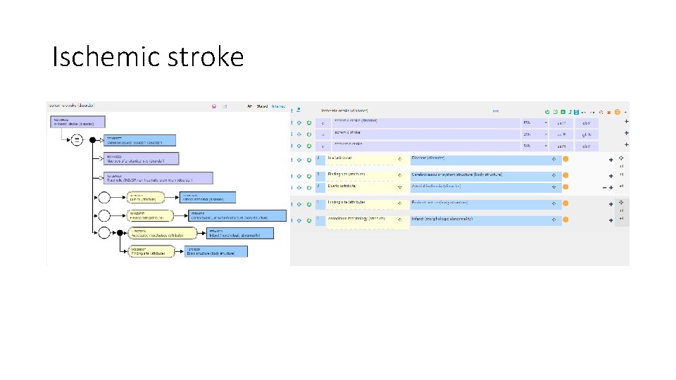 Ischemic stroke 
