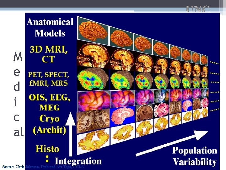 M e d i c al Source: Chris Johnson, Utah and Art Toga, UCLA