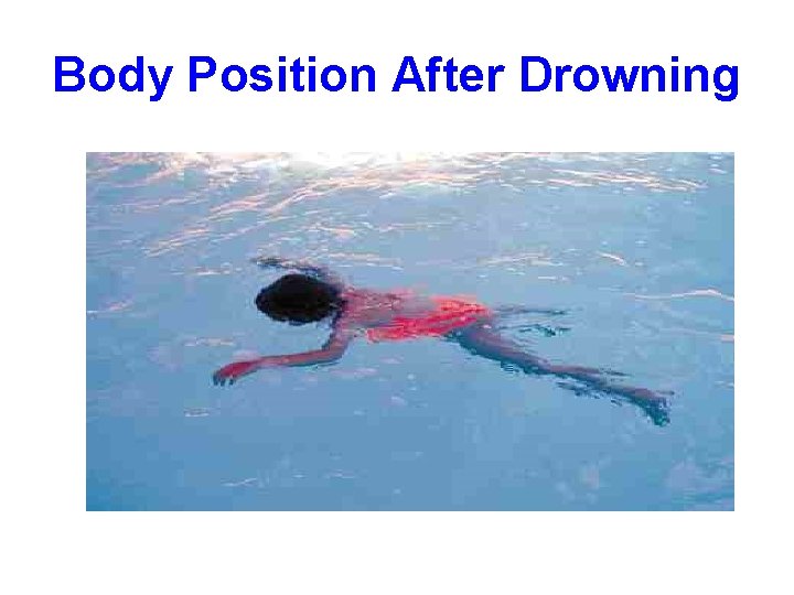 Body Position After Drowning 