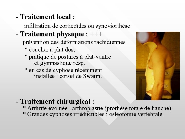 - Traitement local : infiltration de corticoïdes ou synoviorthèse - Traitement physique : +++