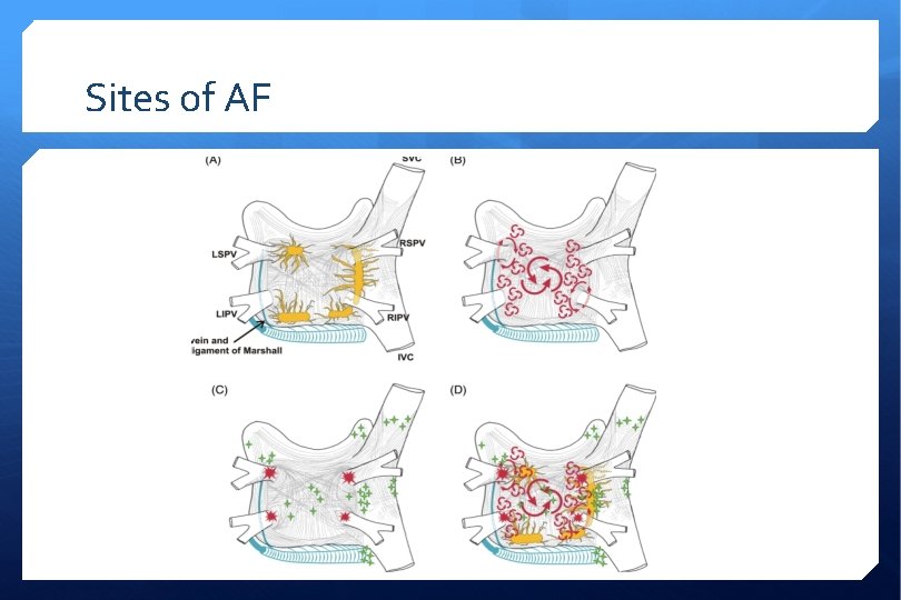 Sites of AF 