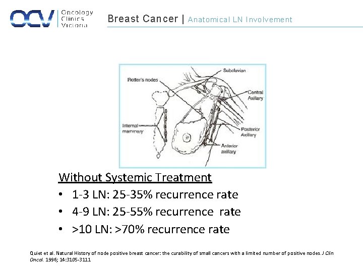 Breast Cancer | Anatomical LN Involvement Without Systemic Treatment • 1 -3 LN: 25