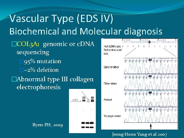 Vascular Type (EDS IV) Biochemical and Molecular diagnosis �COL 3 A 1 genomic or