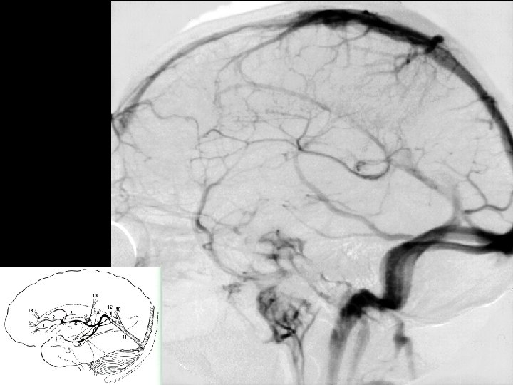 Michigan Neurosurgery 