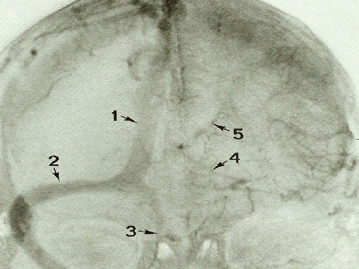 Michigan Neurosurgery 