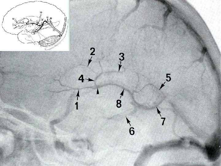 Michigan Neurosurgery 