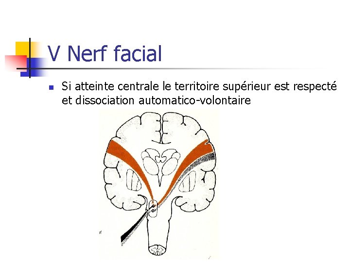 V Nerf facial n Si atteinte centrale le territoire supérieur est respecté et dissociation